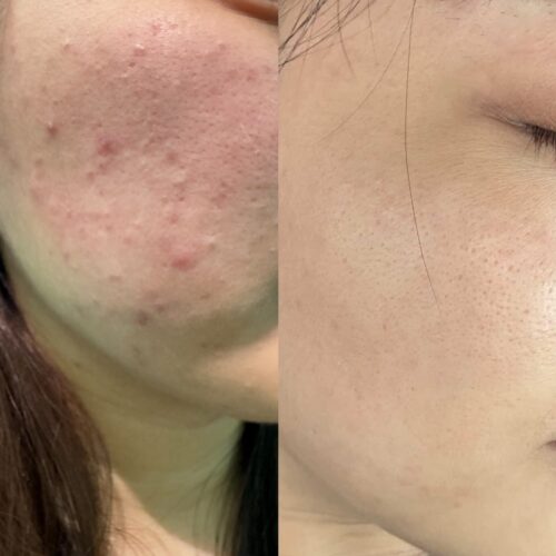 Aura Face Mist 100ml photo review